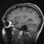 Scan van menselijk brein