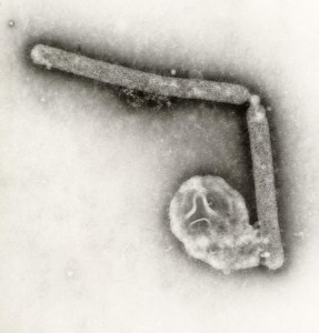 Virusdeeltje van H5N1, vogelgriep 